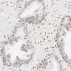 Immunohistochemical staining of human prostate shows weak to moderate nuclear positivity in glandular cells.