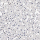 Immunohistochemical staining of human liver shows no positivity in hepatocytes as expected.