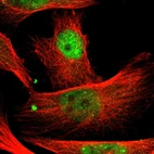 Immunofluorescent staining of human cell line U-251 MG shows localization to nucleoplasm.