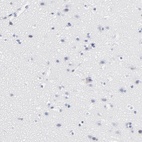 Immunohistochemical staining of human cerebral cortex shows low expression as expected.