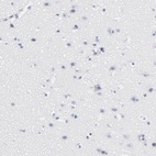 Anti-CD2 Antibody