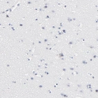 Immunohistochemical staining of human cerebral cortex shows low expression as expected.