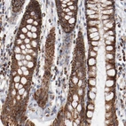 Immunohistochemical staining of human rectum shows moderate positivity in cytoplasm granular in glandular cells.