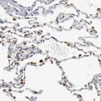 Immunohistochemical staining of human lung shows moderate cytoplasmic positivity in macrophages.