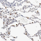 Immunohistochemical staining of human lung shows strong positivity in cytoplasm granular in macrophages.