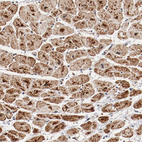 Immunohistochemical staining of human testis shows strong cytoplasmic positivity in cells in seminiferous ducts.