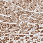 Immunohistochemical staining of human heart muscle shows strong positivity in cytoplasm granular in cardiomyocytes.
