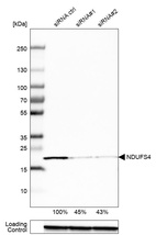 Western blot analysis in HEK293 cells transfected with control siRNA, target specific siRNA probe #1 and #2, using Anti-NDUFS4 antibody. Remaining relative intensity is presented. Loading control: Anti-GAPDH.