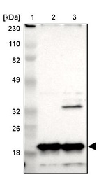 Lane 1: Marker [kDa] 230, 110, 82, 49, 32, 26, 18_br/_Lane 2: Human cell line RT-4_br/_Lane 3: Human cell line U-251MG sp