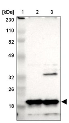 Lane 1: Marker [kDa] 230, 110, 82, 49, 32, 26, 18_br/_Lane 2: Human cell line RT-4_br/_Lane 3: Human cell line U-251MG sp