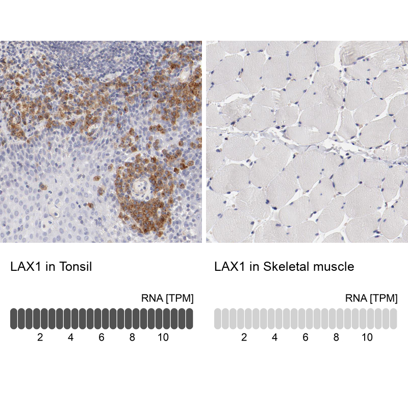 Anti-LAX1 Antibody