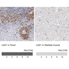 Anti-LAX1 Antibody
