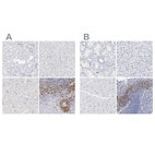 Immunohistochemical staining of human kidney, liver, skeletal muscle and tonsil using Anti-LAX1 antibody HPA003887 (A) shows similar protein distribution across tissues to independent antibody HPA002461 (B).
