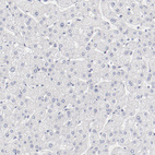 Immunohistochemical staining of human liver shows no positivity as expected.