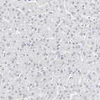 Immunohistochemical staining of human liver shows no positivity as expected.