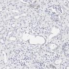 Immunohistochemical staining of human kidney shows no positivity as expected.