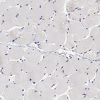 Immunohistochemical staining of human skeletal muscle shows no positivity as expected.