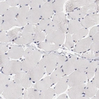 Immunohistochemical staining of human skeletal muscle shows no positivity as expected.