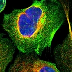 Immunofluorescent staining of human cell line U-2 OS shows localization to plasma membrane & cytosol.