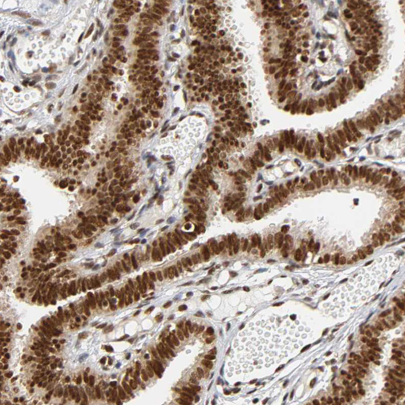 Anti-RNF122 Antibody