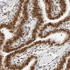 Anti-RNF122 Antibody