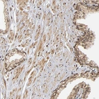 Immunohistochemical staining of human prostate shows strong nuclear positivity in smooth muscle cells.