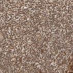 Immunohistochemical staining of human tonsil shows strong nuclear positivity in non-germinal center cells.