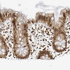 Immunohistochemical staining of human colon shows strong nuclear positivity in glandular cells.