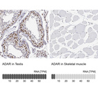 Anti-ADAR Antibody