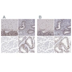 Immunohistochemical staining of human cerebellum, endometrium, skeletal muscle and testis using Anti-ADAR antibody HPA003890 (A) shows similar protein distribution across tissues to independent antibody HPA051519 (B).