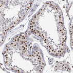 Immunohistochemical staining of human testis shows moderate to strong nuclear positivity in a subset of cells in seminiferous ducts.
