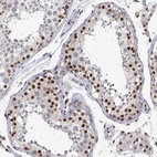 Immunohistochemical staining of human testis shows moderate to strong nuclear positivity in a subset of cells in seminiferous ducts.