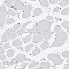 Immunohistochemical staining of human skeletal muscle shows no positivity in myocytes as expected.