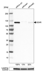 Western blot analysis in U-251MG cells transfected with control siRNA, target specific siRNA probe #1 and #2, using Anti-ADAR antibody. Remaining relative intensity is presented. Loading control: Anti-GAPDH.