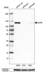 Western blot analysis in U-251MG cells transfected with control siRNA, target specific siRNA probe #1 and #2, using Anti-ADAR antibody. Remaining relative intensity is presented. Loading control: Anti-GAPDH.