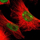 Immunofluorescent staining of human cell line U-251 MG shows localization to nucleoplasm & nucleoli.