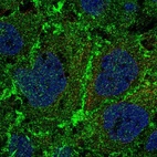 Anti-PTPRM Antibody