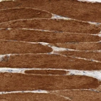 Immunohistochemical staining of human skeletal muscle shows strong cytoplasmic positivity in myocytes.