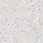 Immunohistochemical staining of human heart shows no cytoplasmic positivity in cardiomyocytes as expected.