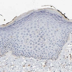 Immunohistochemical staining of human skin shows no cytoplasmic positivity in squamous epithelial cells as expected.