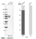 Western blot analysis in human cell lines Caco-2 and MCF-7 using Anti-BIN1 antibody. Corresponding BIN1 RNA-seq data are presented for the same cell lines. Loading control: Anti-PPIB.