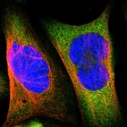 Immunofluorescent staining of human cell line U-2 OS shows localization to cytosol.