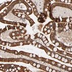 Anti-REEP5 Antibody