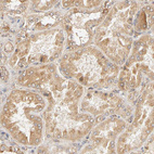 Anti-EPS8 Antibody