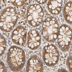Immunohistochemical staining of human rectum shows moderate cytoplasmic positivity in glandular cells.