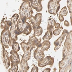 Immunohistochemical staining of human placenta shows moderate cytoplasmic positivity in trophoblastic cells.