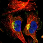Immunofluorescent staining of human cell line U-251 MG shows localization to the Golgi apparatus.