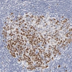 Immunohistochemical staining of human appendix shows high expression.