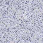 Anti-MCM7 Antibody