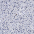 Immunohistochemical staining of human pancreas shows low expression as expected.